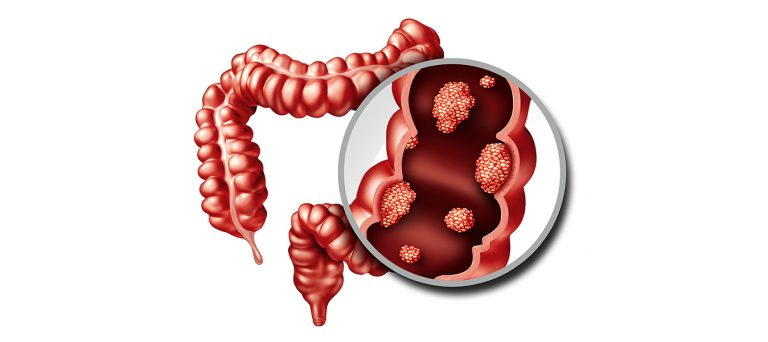 Lợi khuẩn đường ruột có nhiệm vụ quan trọng trong hệ tiêu hóa
